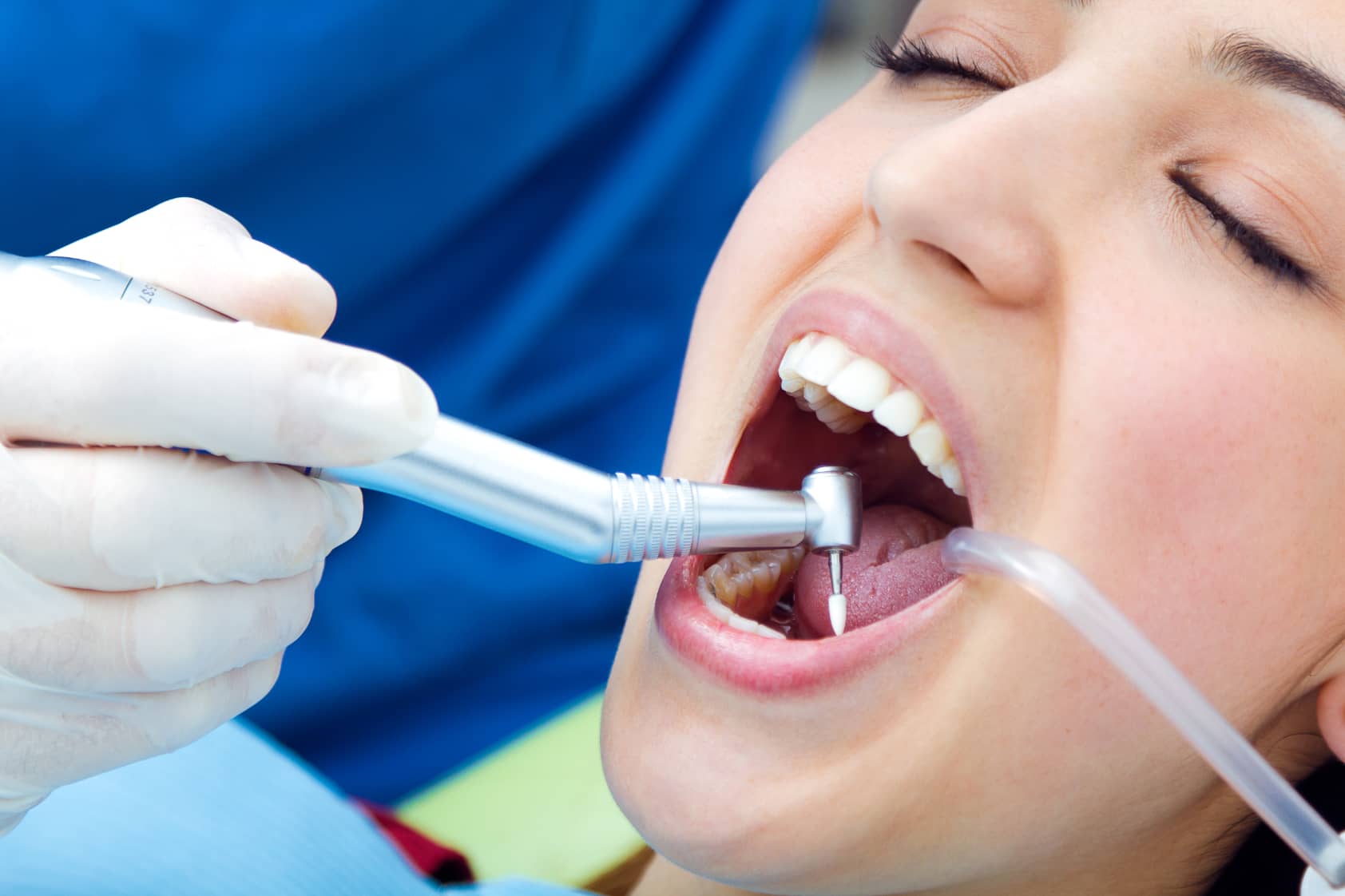 Endodoncia - La endodoncia es un procedimiento dental conocido habitualmente para “matar el nervio”. Consiste en eliminar la parte profunda del diente cuando se encuentra lesionado o infectado. La finalidad de este procedimiento es limpiar el diente por dentro y rellenarlo de un material inerte. 
            El procedimiento se hace bajo anestesia local, por lo cual no resulta doloroso. 
