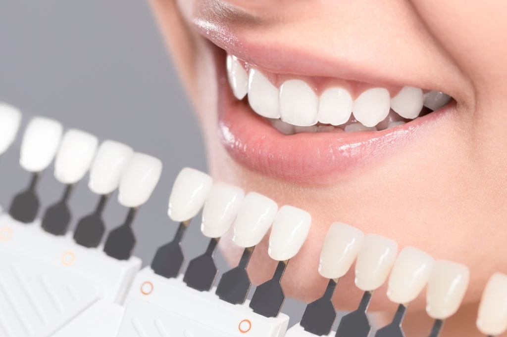 Resinas - Una resina dental es un relleno sintético que se utiliza para restaurar la estructura de los dientes que se han dañado como resultado de caries o lesiones como fisuras o grietas; la resina permite que el diente recupere su aspecto, funcionalidad y salud.